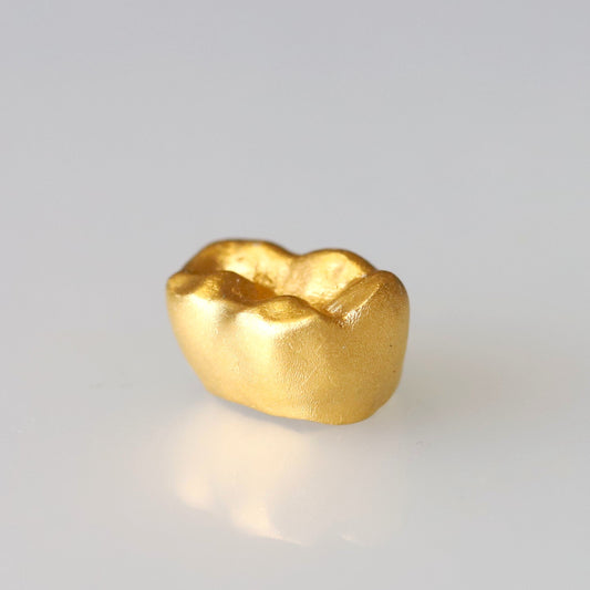 金乳歯(奥歯・ディスプレイタイプ)※金乳歯の素材費用は別途