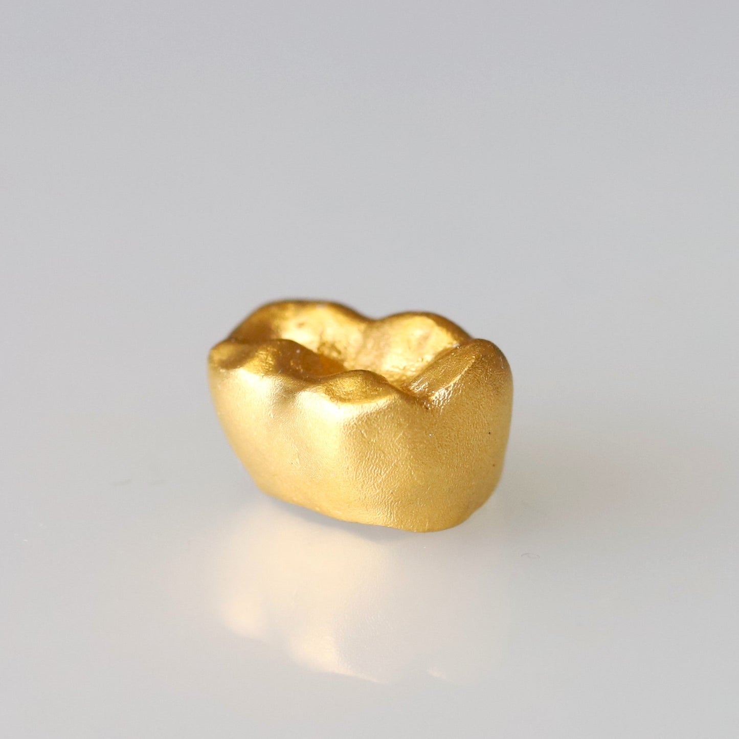 金乳歯(奥歯・ディスプレイタイプ）※金乳歯の素材費用は別途